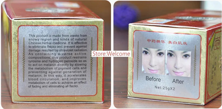 Chinese 2026 Whitening  Day Night Cream Set Melasma Dark Age Dark Spots Freckle Remover Skin Lightening Skin Care