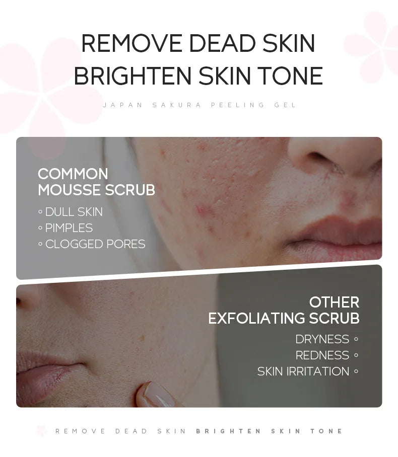 LAIKOU Exfoliating Face Scrub Peeling Gel Moisturizing Whitening Sakura Japan Remove Blackhead Acne Detoxifies & Clean All Skin