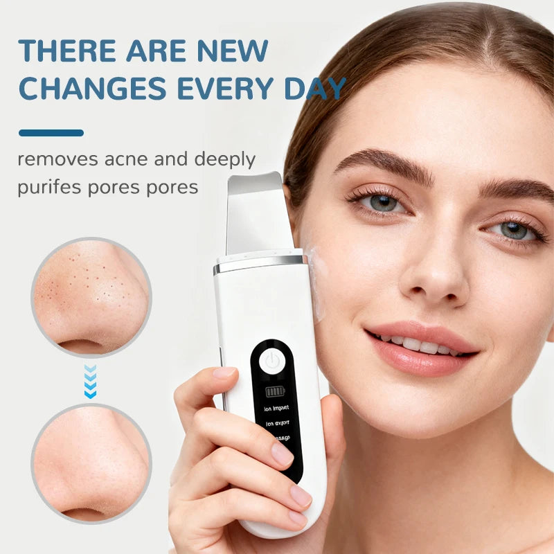 Lady Care Ultrasonic Skin Scrubber 4 in 1 Ion Import Export Facial Cleansing Spatula Blackhead Remover for Pore Purifying