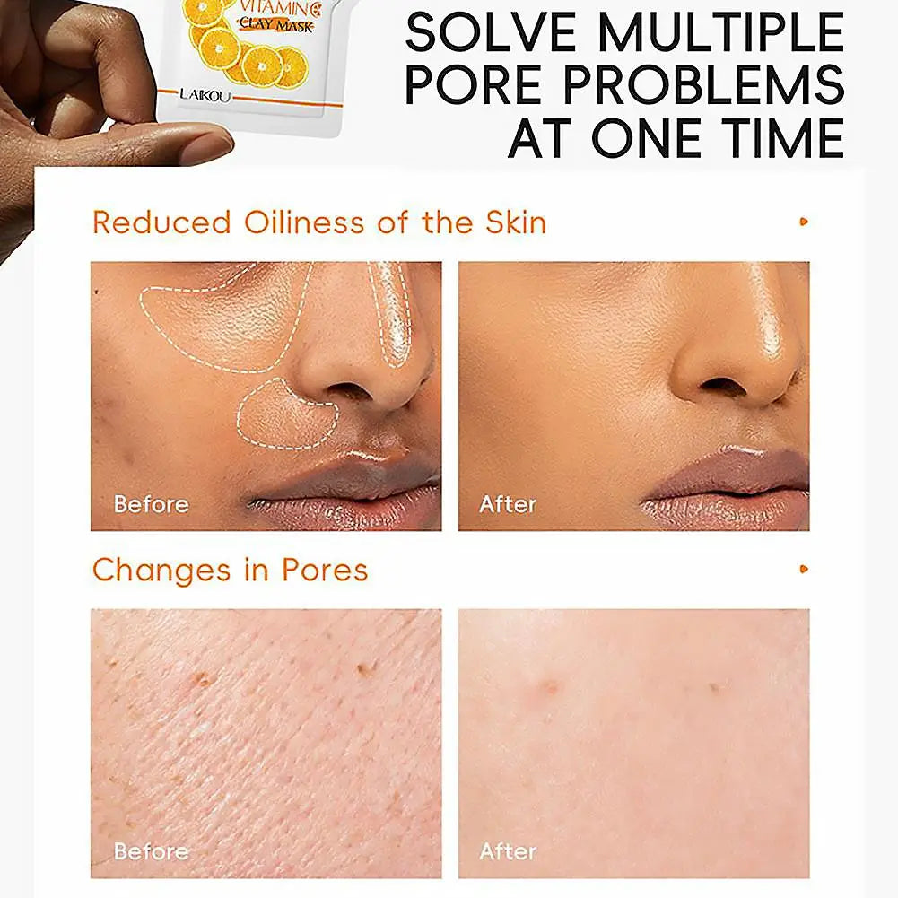 LAIKOU Mud Mask Deep Cleansing Remove Acne Oil Control Mask Hydrating Smooting Face Skin Balance Skin Tone Mud Mask for Women
