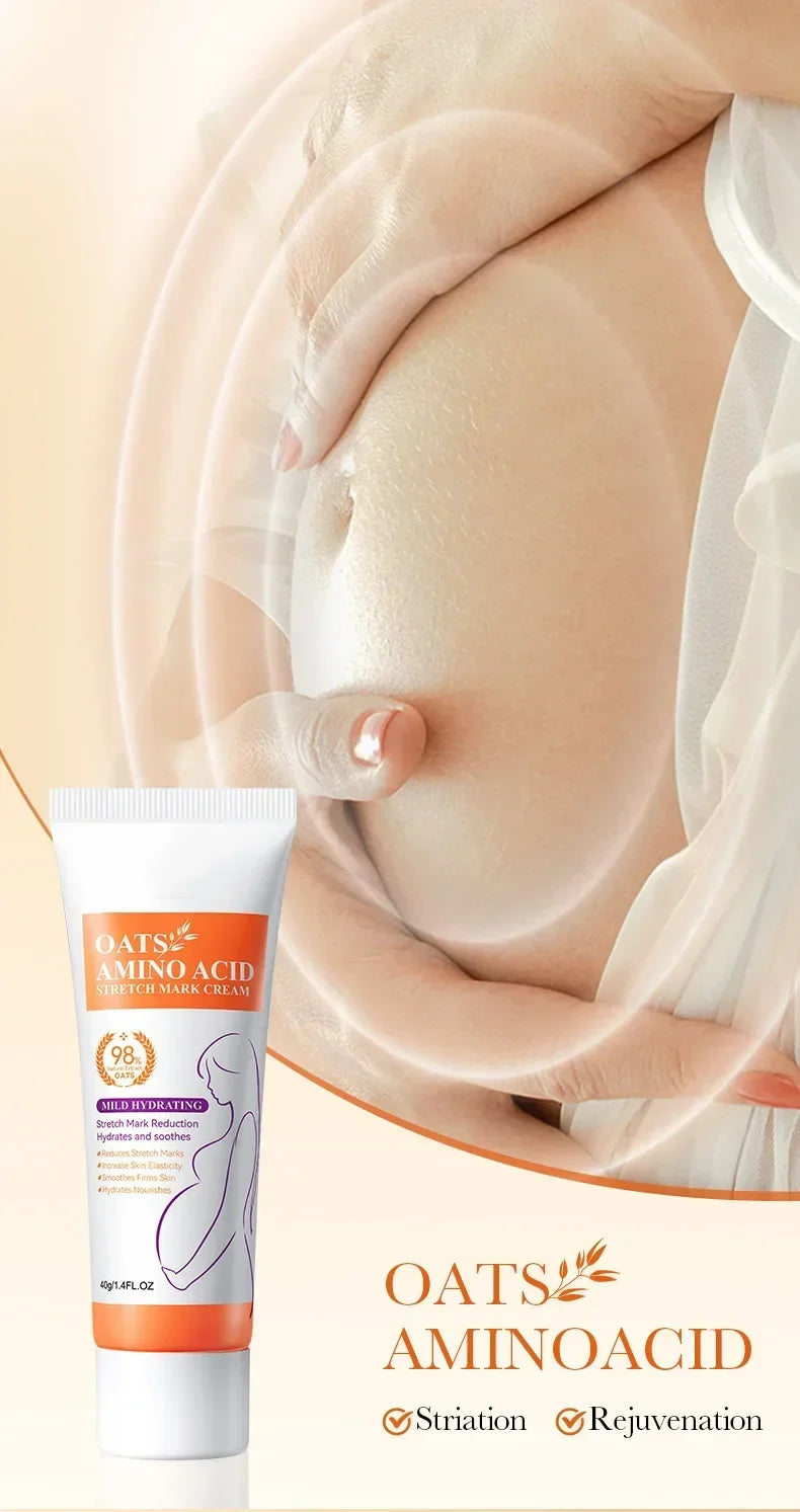 Stretch Marks Removal Cream Light Lines Postpartum Obesity Pregnancy Powerful Fast Absorption