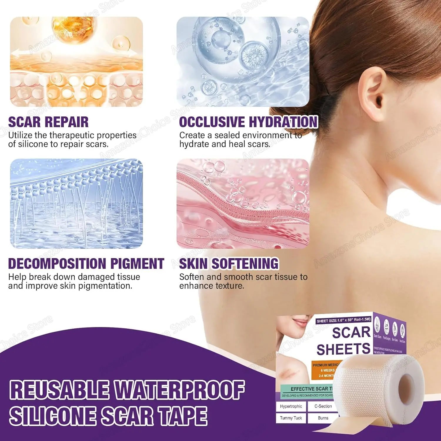 0.5M/1.5M/3M*4cm Silicone Scar Sheets Removal Strips Silicone Gel Scar Strip For Acne Keloid Surgery Burn Treatment Scar Patch