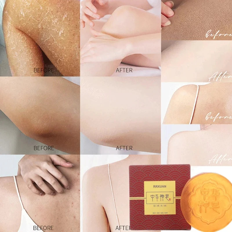 Body Natural Herb Soap For Deep Skin Exfoliation Brightening Body Soap Knees Intimate Parts Armpits Light Nourishing Care Soap