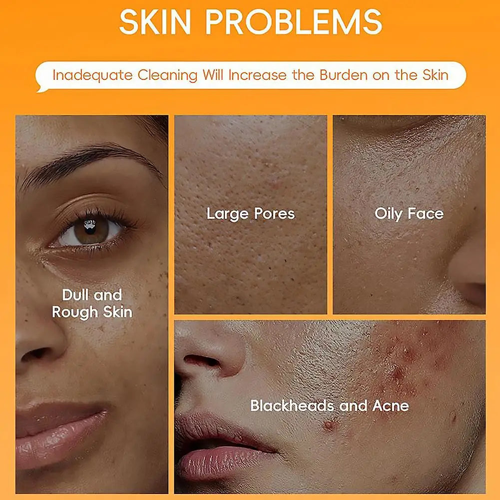 LAIKOU Mud Mask Deep Cleansing Remove Acne Oil Control Mask Hydrating Smooting Face Skin Balance Skin Tone Mud Mask for Women