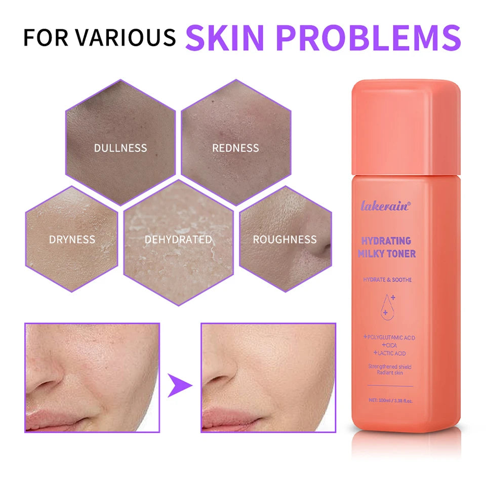 Hydrating Milky Toner Repair Skin Ultra Hydrating Toner for Face Soothes Skin Moisture Reduces Redness Barrier Skincare