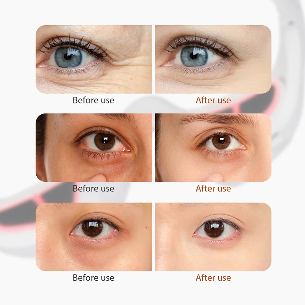 Foreverlily Eye Massager Relieves Eye Fatigue Eyes Massage Glasses Eye Fatigue Relief Massager Under-Eye Glasses Massager