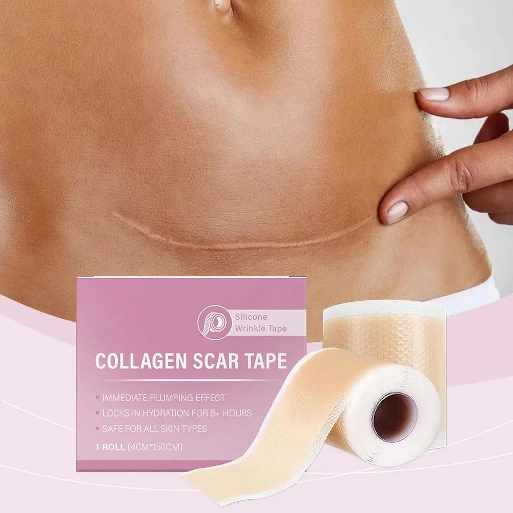 Hot Sale 1 Roll Silicone Scar Sheet Effective Scar Waterproof Breathable Painless Scar Repair Tape Roll Beauty Sticker 2025 New