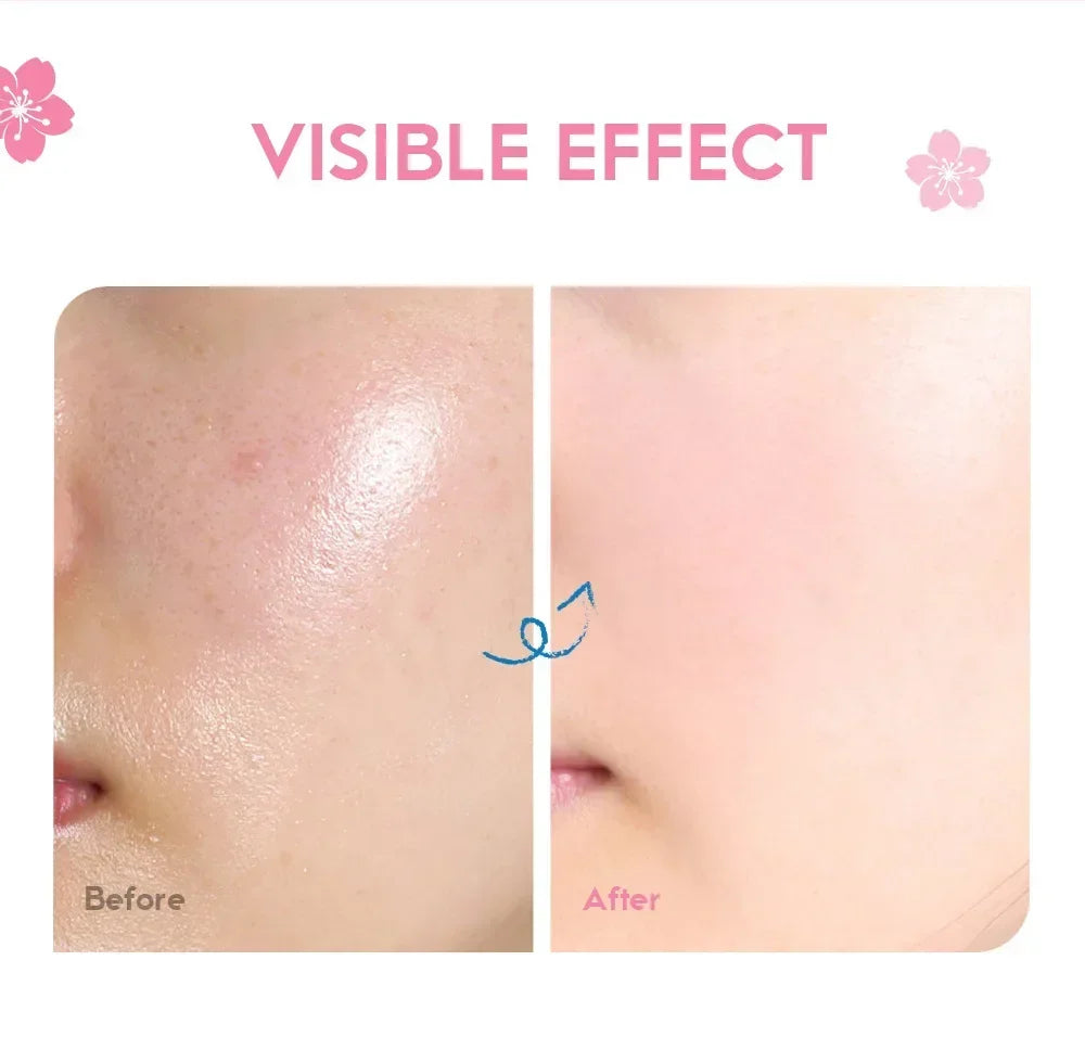 LAIKOU Sakura Hydrating Cream Moisturizer Whitening Nourishing Oil Control Moisturizing & Repairing Deep Hydration Lock Gentle