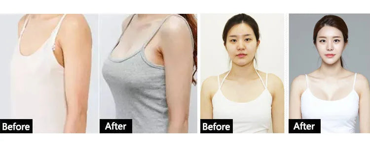 Breast Enlargement Essential Oil Frming Enhancement Breast Enlarge Big Bust Enlarging Bigger Chest Massage Prevents Sagging Care