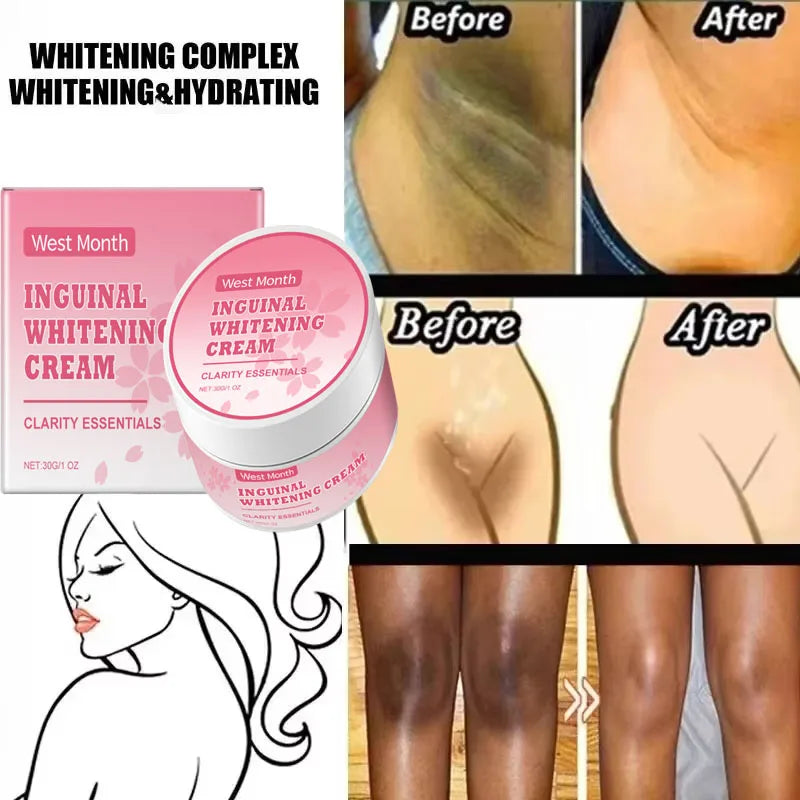 Niacinamide Body Whitening Cream For Underarm Bleaching Armpit Lightening Intimate Area  Moisturizer Korean Skin Care Product