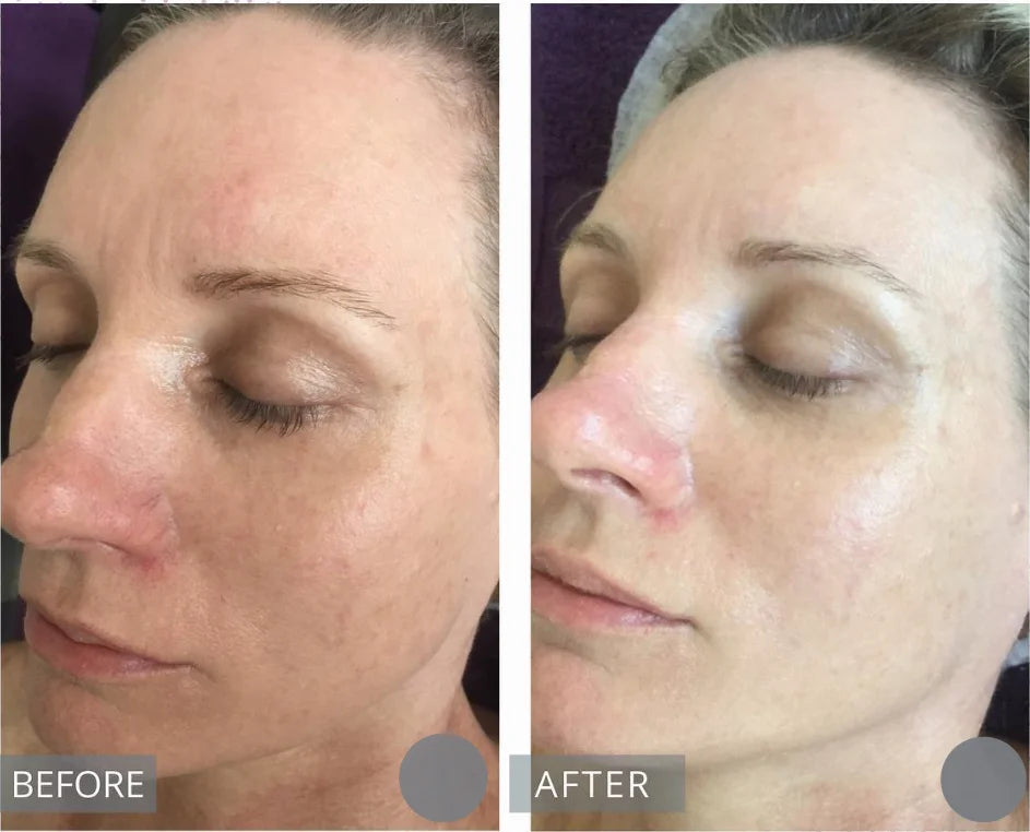 Centella Serum Nourish Improvement Dry Skin Smoothing Tightening Brightening Moisturizing Hyaluronic Acid Face Essence Skin Care