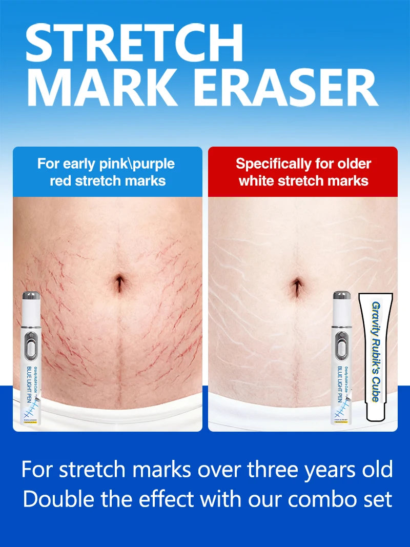 2026 New Blue Light Pen to Solve Body Stretch Marks, Postpartum Skincare Tools