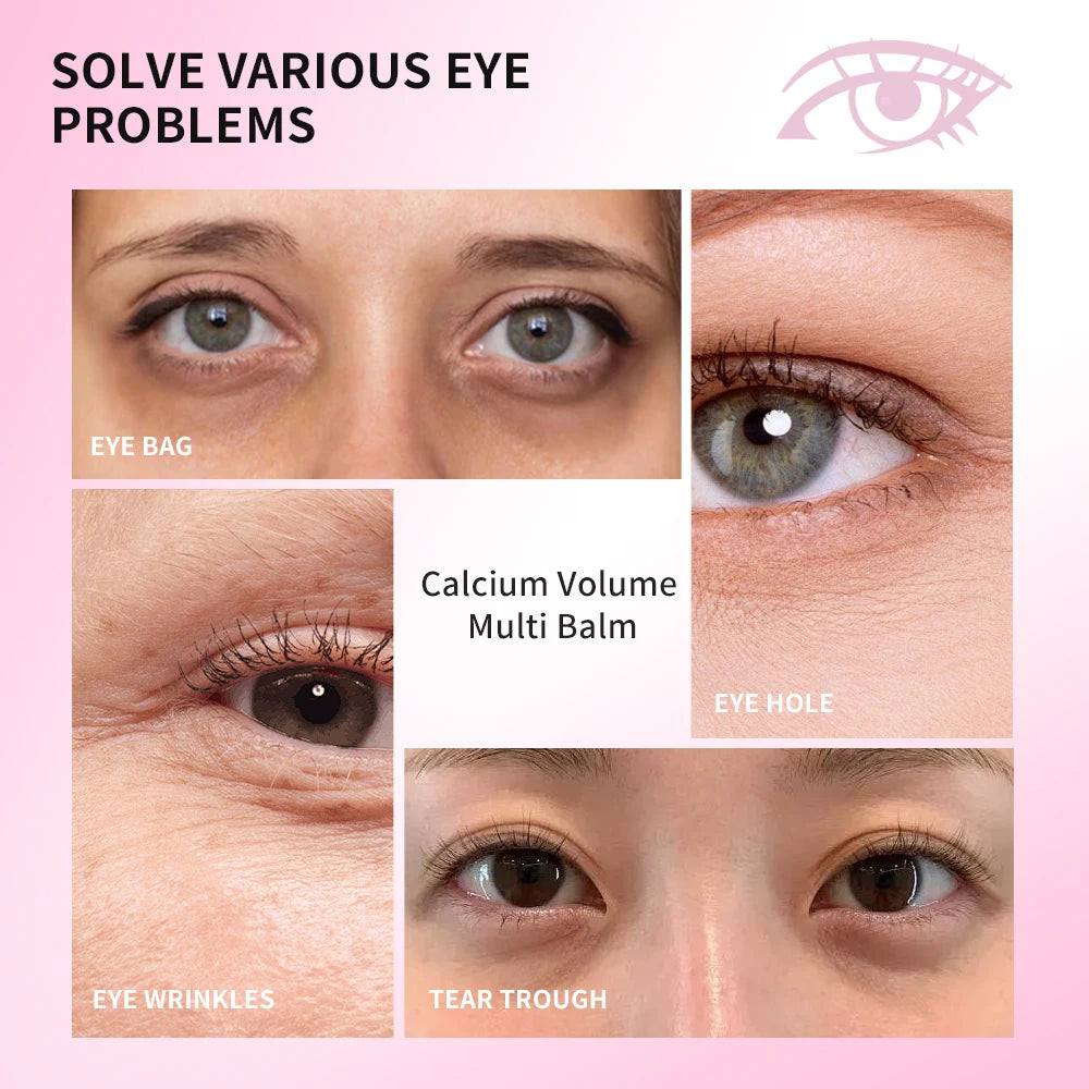 Calcium Collagen Vitamin D Eye Stick Balm Tightens Skin Care Anti Aging Anti Dark Circle Reduces Eye Bags Wrinkles Tear Trough