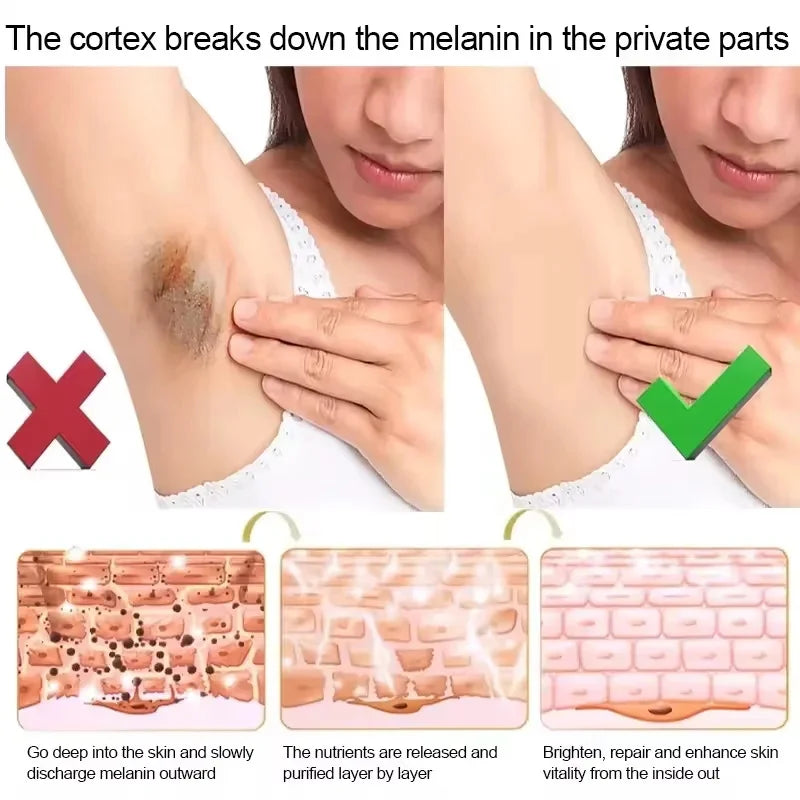 Remove Melanin Nicotinamide Brightening Cream For Dark Skin Effective Lighten Thigh Inner Bleach Private Parts Brighten Cream