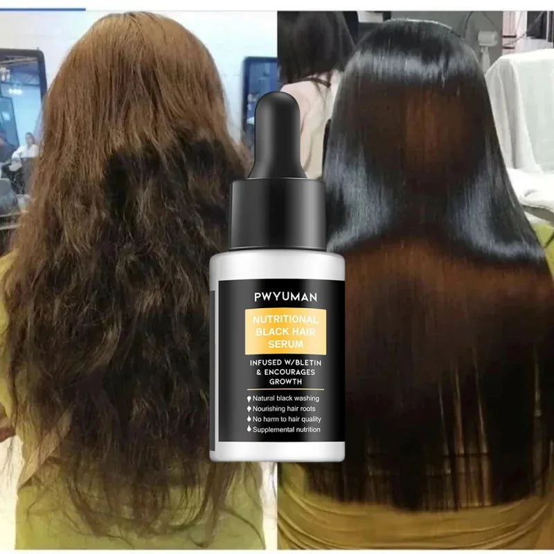 Fast Anti Dandruff Hair Treatment Soap Itching Repair Scalp Cleaning Exfoliating Products Oil Control Antipruritic Hair Care