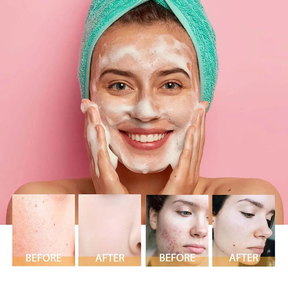 Turmeric Facial Cleanser Facial Scrub Cleansing Oil Control Blackhead Remover Shrink Pores Skin Care Body Care