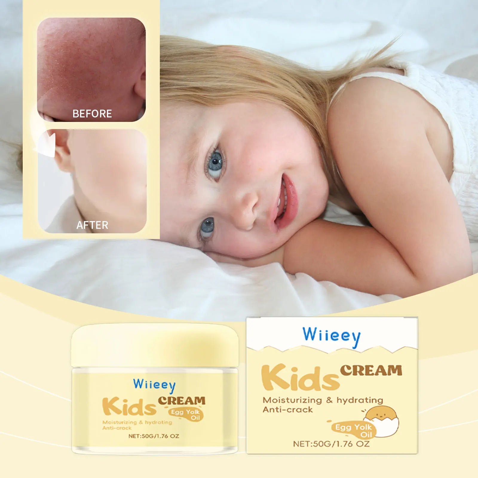 Anti-Cracked Facial Cream for Kids Deep Moisturize Nourish Strengthen Skin Barrier Soothing Dryness No Irritating Baby Bum Cream