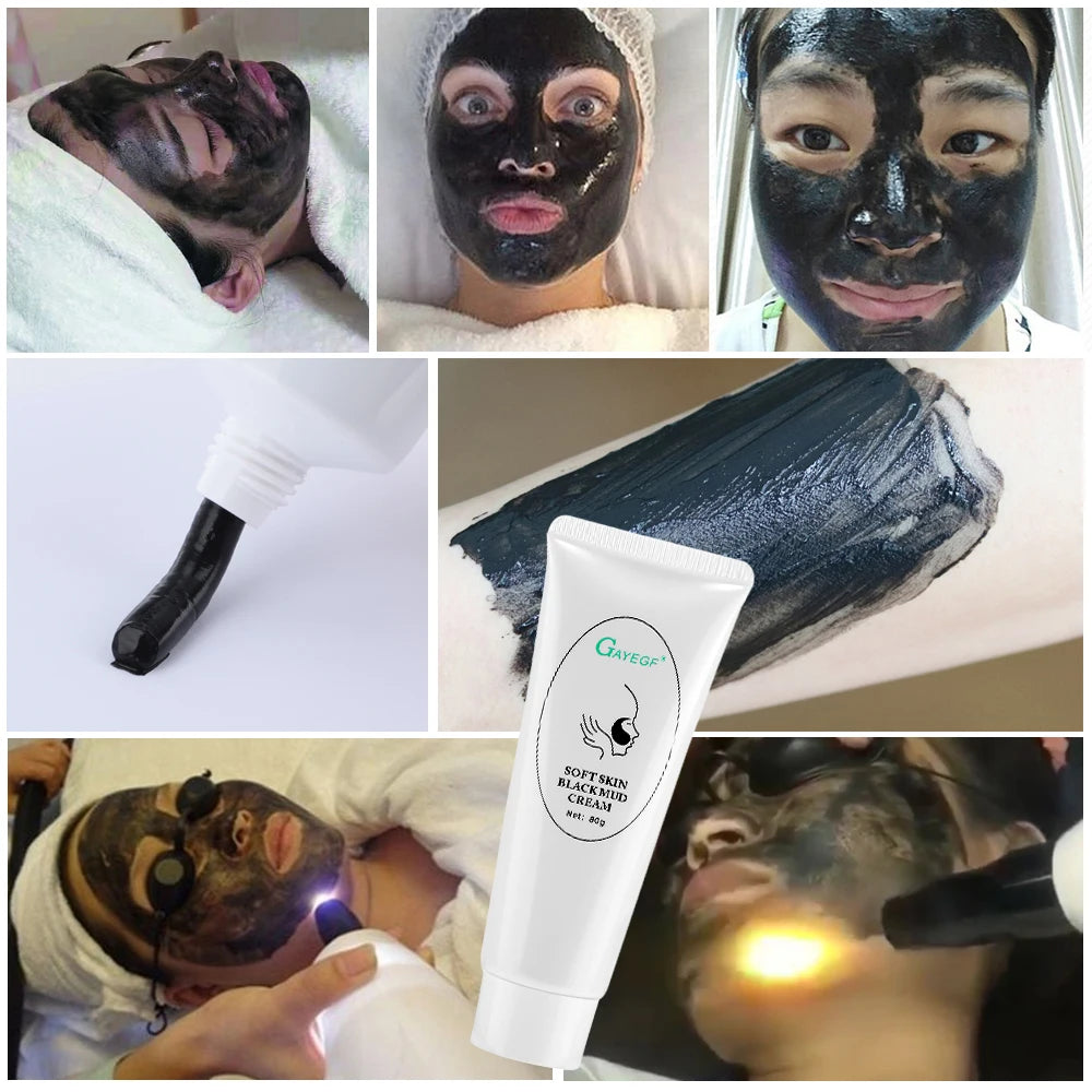Carbon Gel Black Face Cream Mask Facial Deep Cleaning Support Laser Active Nano Toner Skin Rejuvenation Whitening Care Tools