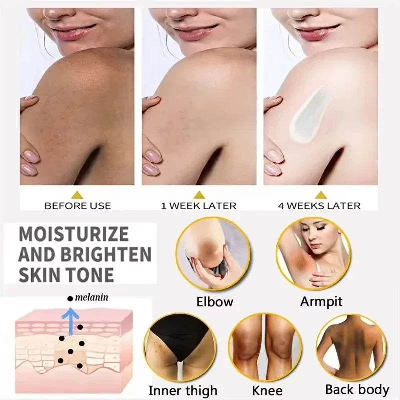 Body Whitening Bleach Cream Brighten Underarm Elbow Knees Joint Removal Intimate Parts Dark Spots Melanin Snow Bleach Cream