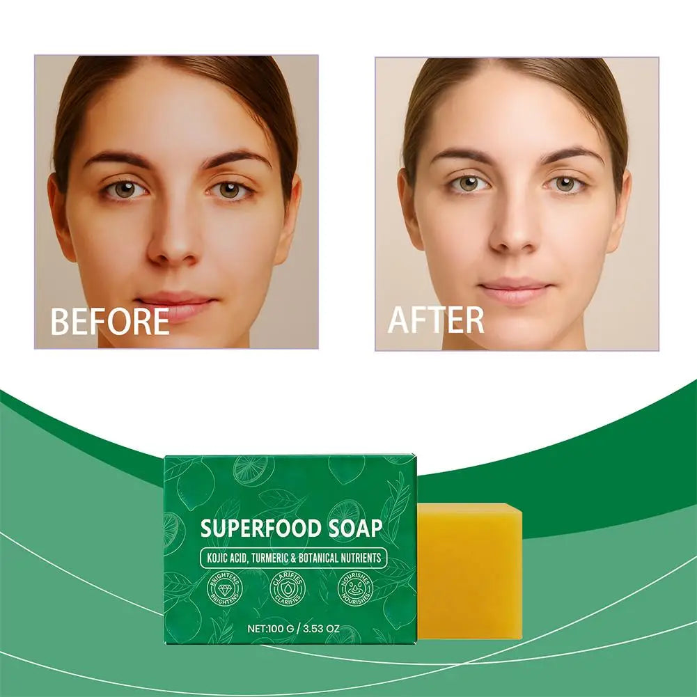 1/2PCS Turmeric Lemon Soap for Dark Spots Removal Skin Brightening Face Body Wash Deep Cleansing Nourishing Hyperpigmentation Ca