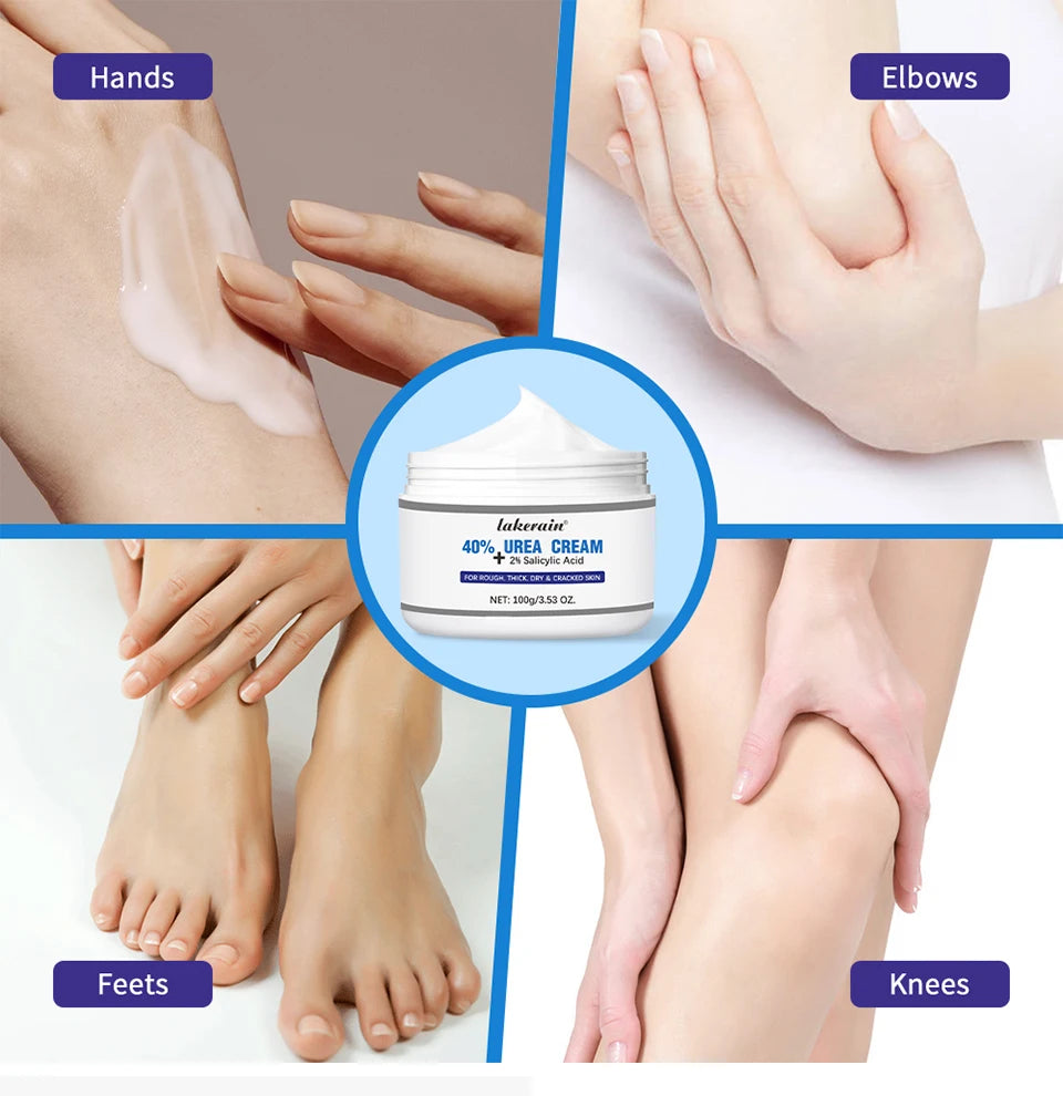 New 42% Urea Cream + 2% Salicylic acid Foot and hand Moisturizer, deep moisturizer and Nourishing moisturizer
