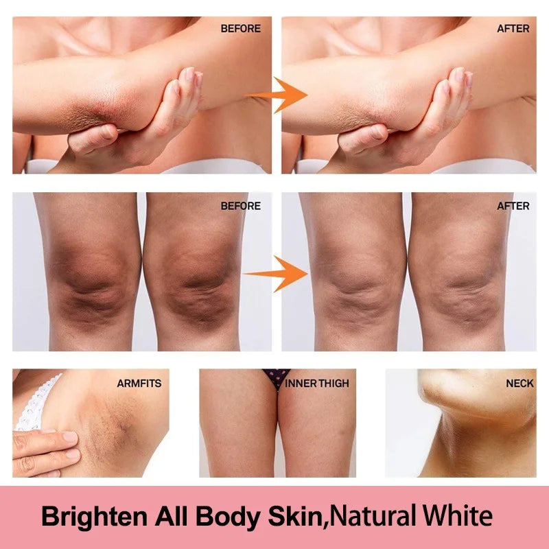 Niacinamide Body Whitening Cream For Underarm Bleaching Armpit Lightening Intimate Area  Moisturizer Korean Skin Care Product