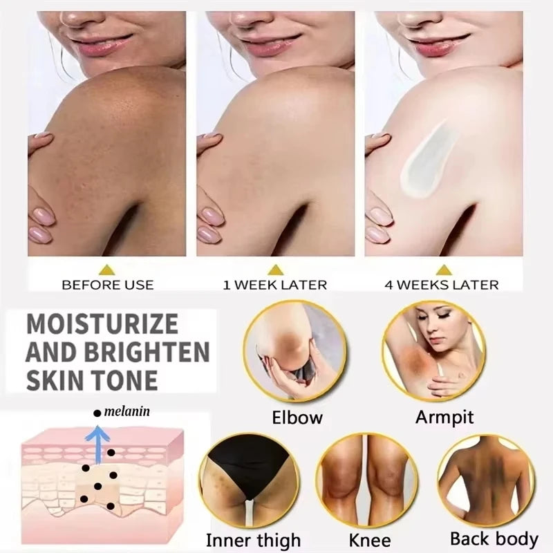 Remove Melanin Nicotinamide Brightening Cream For Dark Skin Effective Lighten Thigh Inner Bleach Private Parts Brighten Cream
