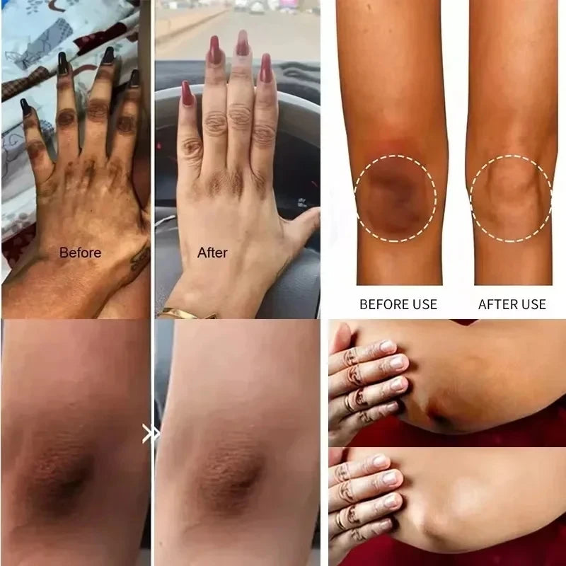 Niacinamide Body Whitening Cream For Underarm Bleaching Armpit Lightening Intimate Area  Moisturizer Korean Skin Care Product