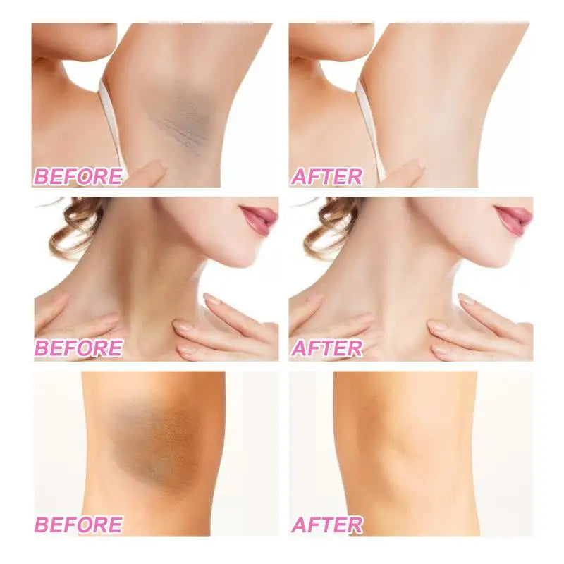 Niacinamide Body Whitening Cream For Underarm Bleaching Armpit Lightening Intimate Area  Moisturizer Korean Skin Care Product