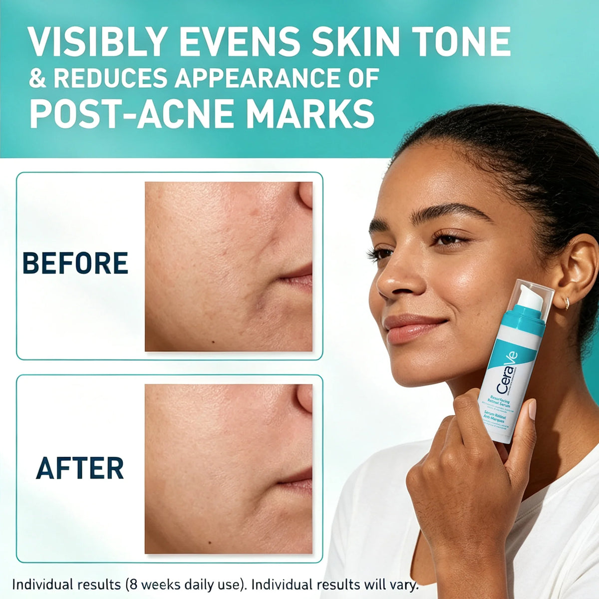 CeraVe Retinol Serum Niacinamide Licorice Root, Skin Smoothing Tone Care, Barrier Repair, Non-Comedogenic For Blemish Prone Skin