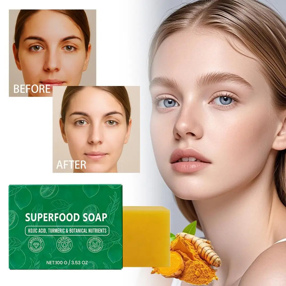 1/2PCS Turmeric Lemon Soap for Dark Spots Removal Skin Brightening Face Body Wash Deep Cleansing Nourishing Hyperpigmentation Ca