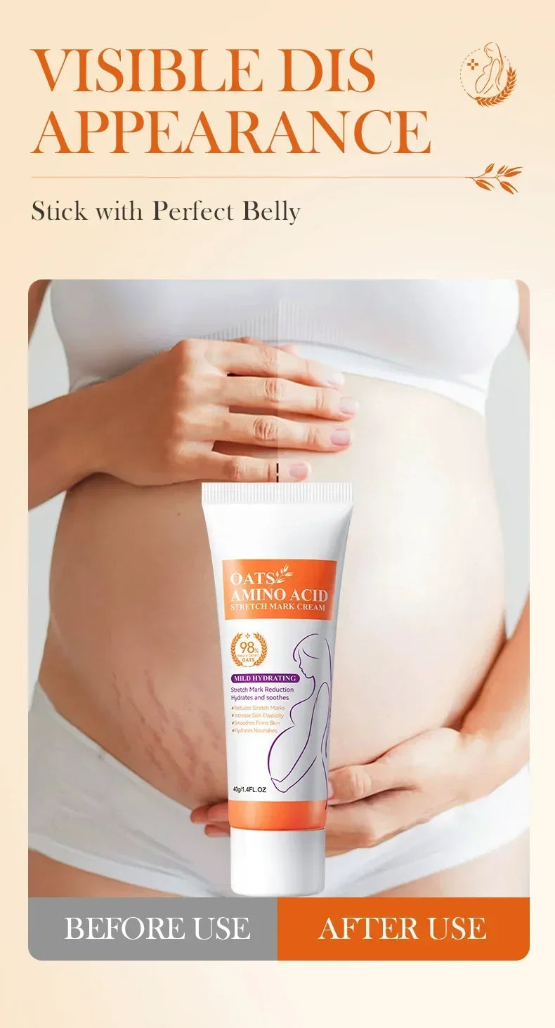Stretch Marks Removal Cream Light Lines Postpartum Obesity Pregnancy Powerful Fast Absorption