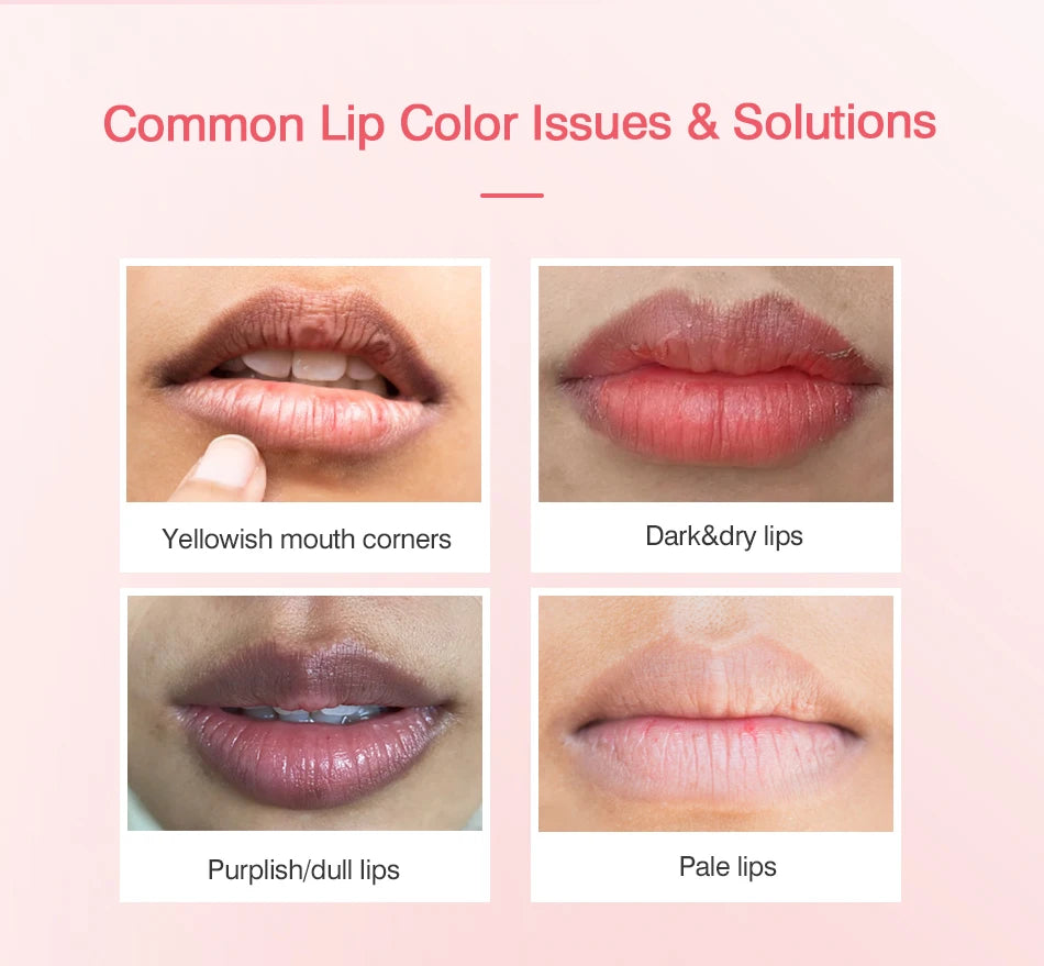 SOBER SKIN Natural Rose Lip Care Rose Scrub Lip Balm Lighten Dark Lip Color Brighten Roma Pink Lip