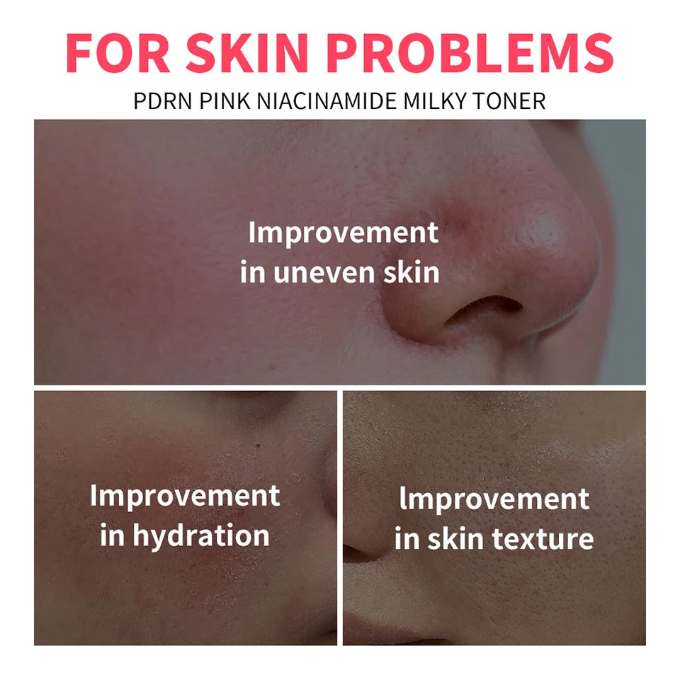 Pink Niacinamide Milky Toner Long-lasting Hydration Even Skin Tone Quickly Absorbed Achieve Dewy Glass Skin Daily Milky Toner