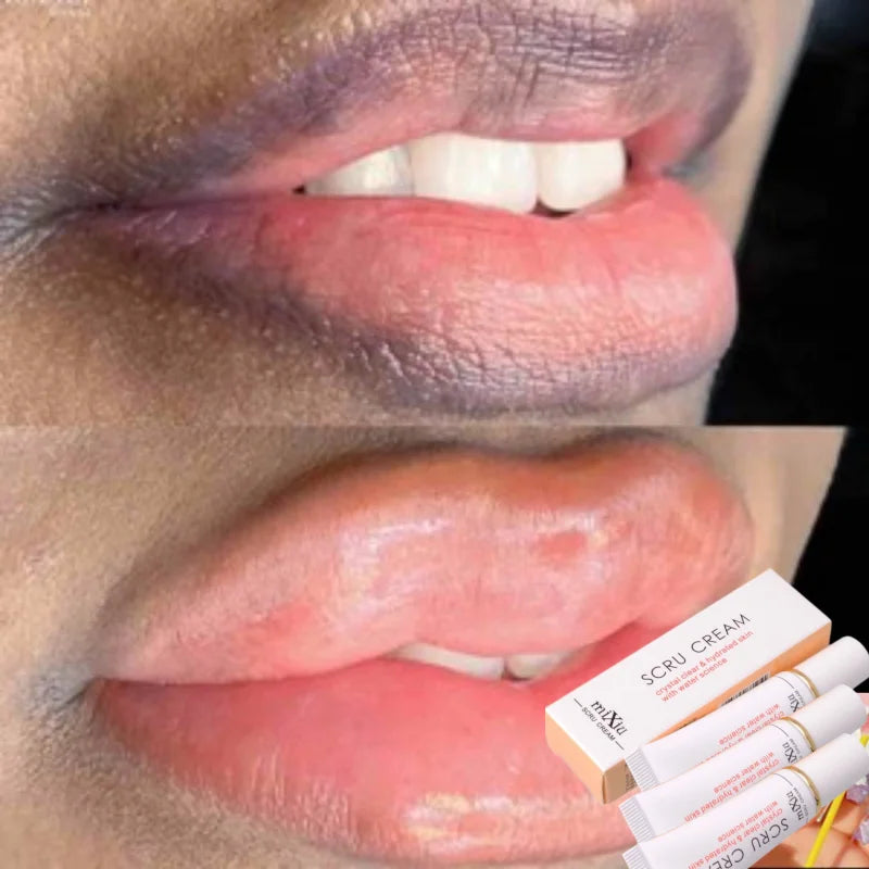Magic Lip Lighten Scrub Dark Black Lip Removal Exfoliation Pigmentation Fade Dull Pink Lip Balm Brighten Anti-Crack Moisturizing