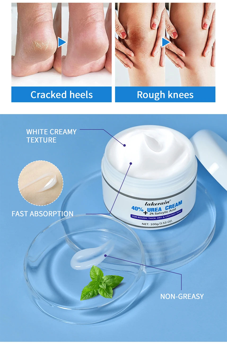 New 42% Urea Cream + 2% Salicylic acid Foot and hand Moisturizer, deep moisturizer and Nourishing moisturizer