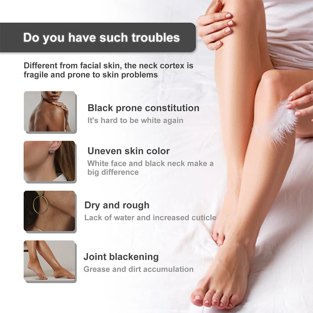 Inner Thigh Black Removing Cream Private Parts Underarm Bleaching Essence Whitening Dark Remove Melanin Skin Whitening Cream