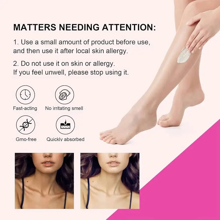 Body Whitening Bleach Cream Brighten Underarm Elbow Knees Joint Removal Intimate Parts Dark Spots Melanin Snow Bleach Cream