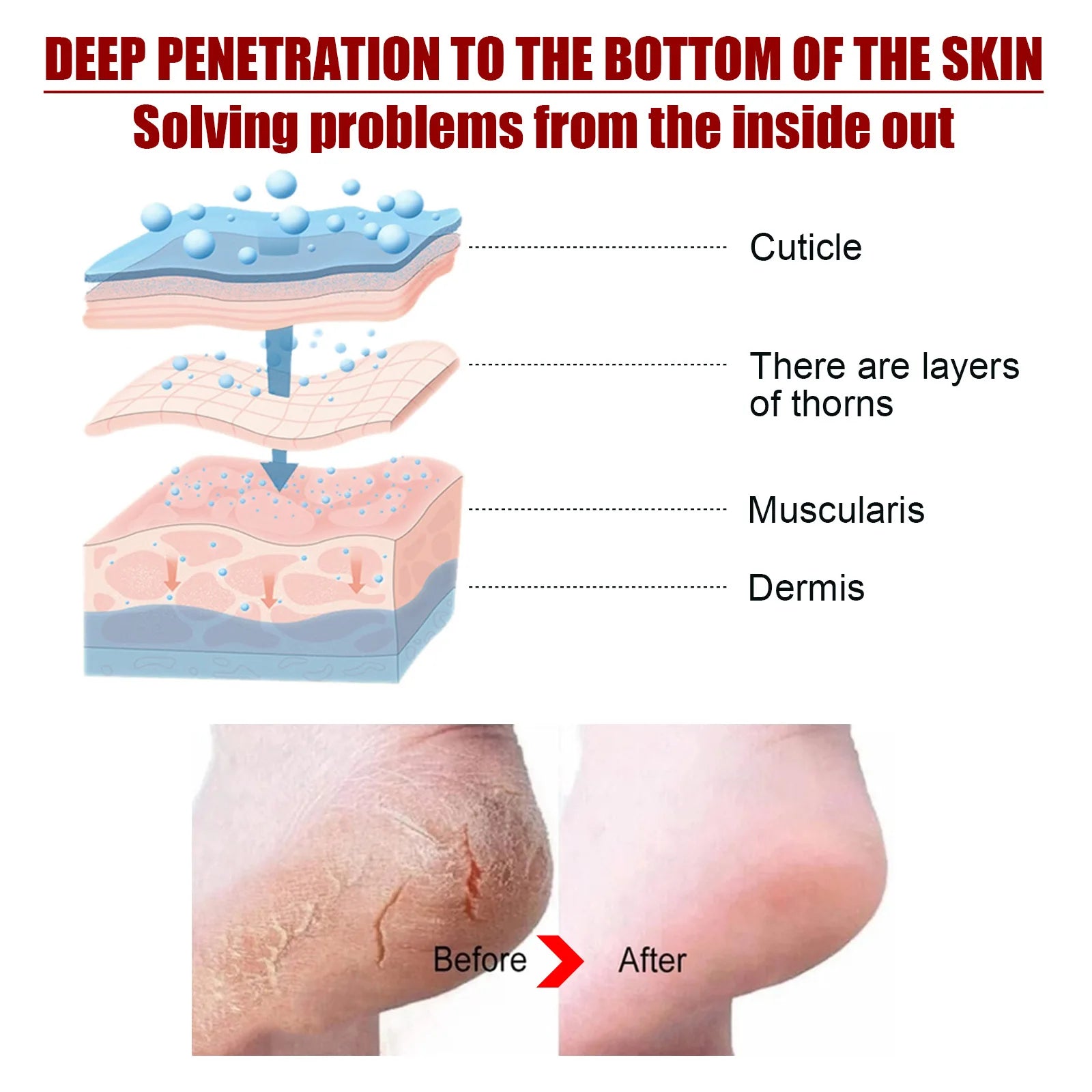 Exfoliating Feet Mask Sock Exfoliation Scrub for Feet Mask Remove Dead Skin Moisturizing Pedicure Anti Crack Foot Patch Spa 5PCS
