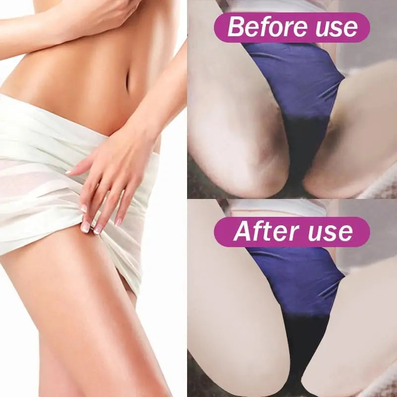 Niacinamide Body Whitening Cream For Underarm Bleaching Armpit Lightening Intimate Area  Moisturizer Korean Skin Care Product