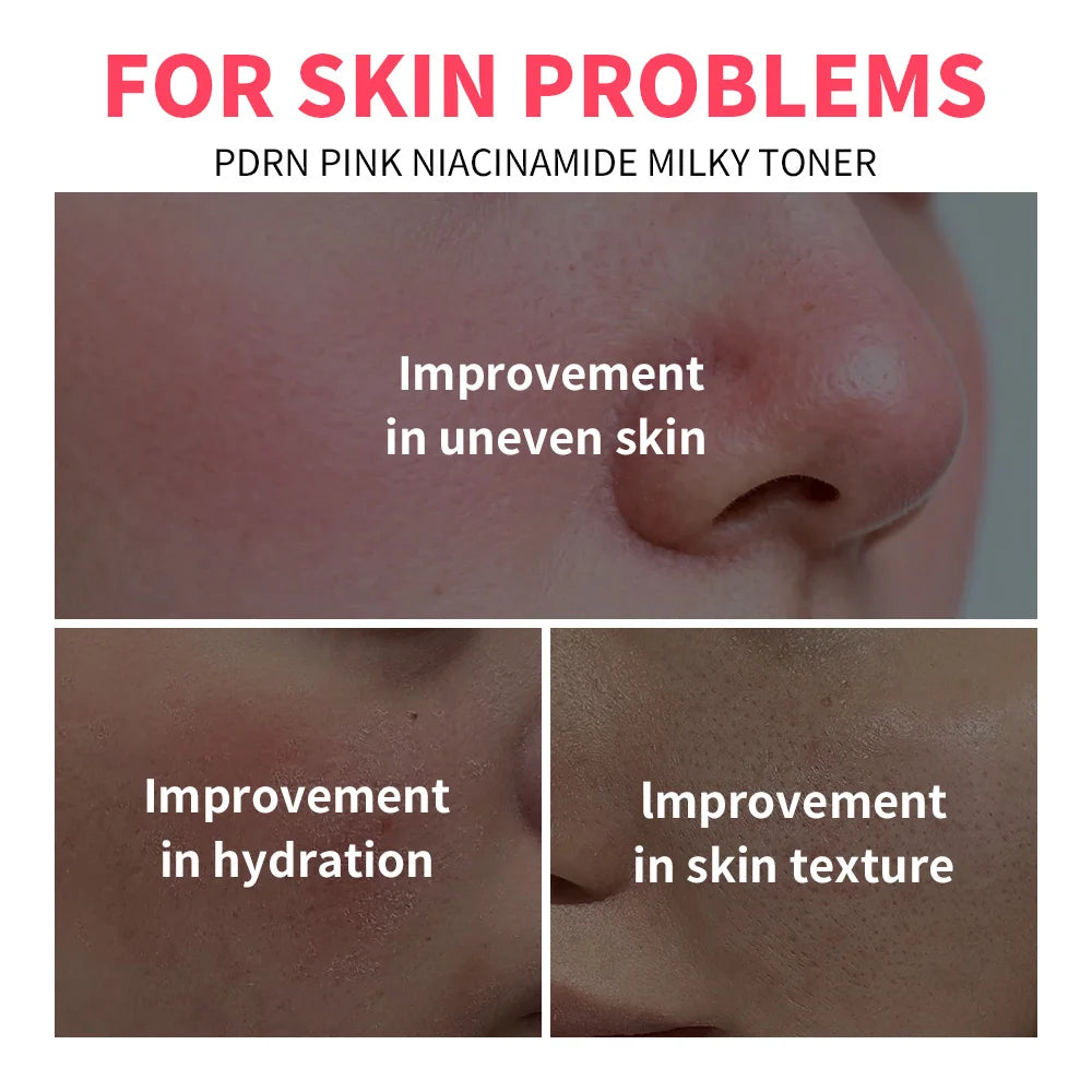 Pink Niacinamide Milky Toner Long-lasting Hydration Even Skin Tone Quickly Absorbed Achieve Dewy Glass Skin Daily Milky Toner
