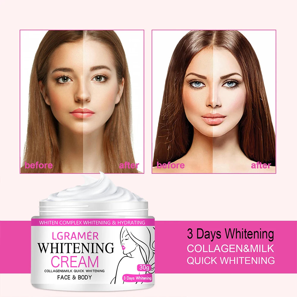 Face Body Brightening Cream Neck Knee Buttocks Thigh Underarm Inner Lightening Lotion Feminine Nourishing Dark Skin Care Cream