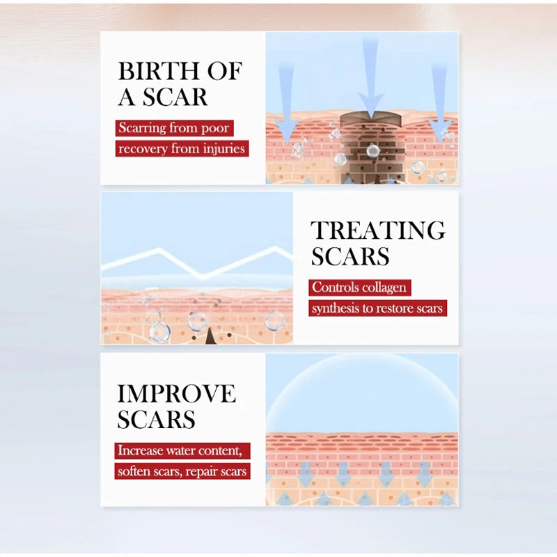 1/2/3PC Scar Repair Cream Fade-out Scald Scar Skin Wound Cream Moisturizing Rejuvenating Hydrating Repair Gel Skin Care Products