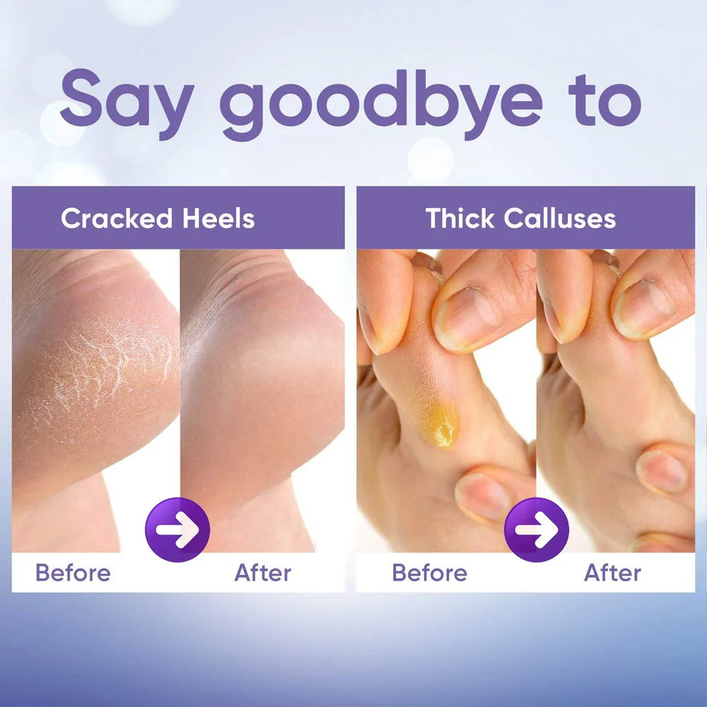 1-20Pair Exfoliating Feet Mask Exfoliating Foot Peel Mask Socks Pedicure Peeling Dead Skin Remover Feet Mask Peel Moisturizing