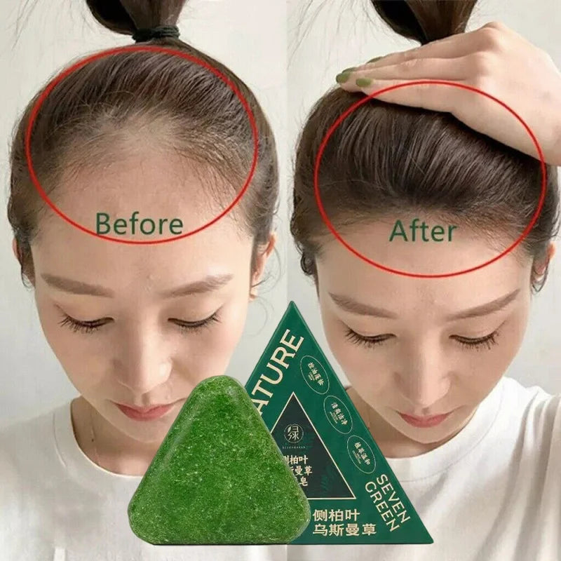 Arborvitae Leaf Shampoo Soap Handmade Natural Herbal Scalp Itching Relief Promote Hair Growth Prevent Hair Loss And DandruffSoap