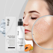 Salicylic Acid Exfoliating Toner 100ml Pore Minimizer Blemish Control Liquid Papaya Extract Hydrating Facial for Acne Prone Skin