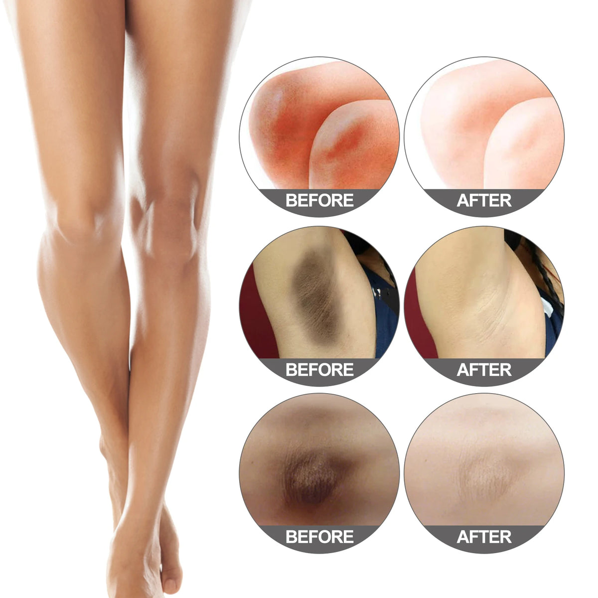 Body Snow Bleach Cream Nicotinamide Brighten Private Parts Underarm Bleaching Armpit Elbow Knees Joint Removal Dark Spot Melanin