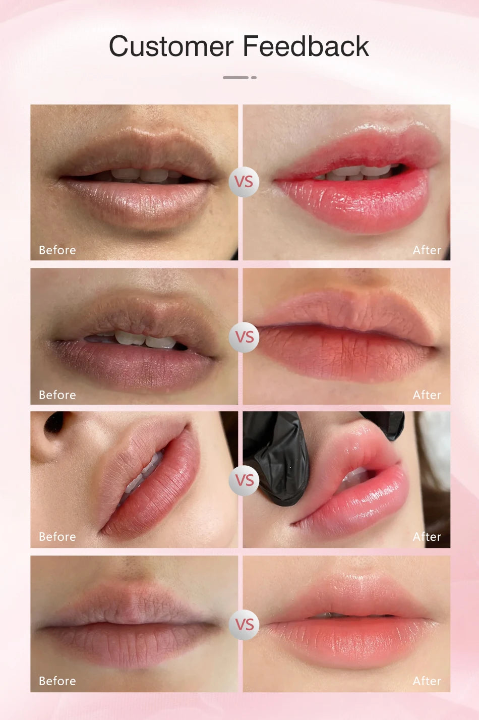 SOBER SKIN Natural Rose Lip Care Rose Scrub Lip Balm Lighten Dark Lip Color Brighten Roma Pink Lip