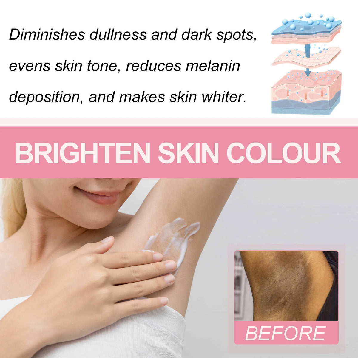 Niacinamide Body Whitening Cream For Underarm Bleaching Armpit Lightening Intimate Area  Moisturizer Korean Skin Care Product
