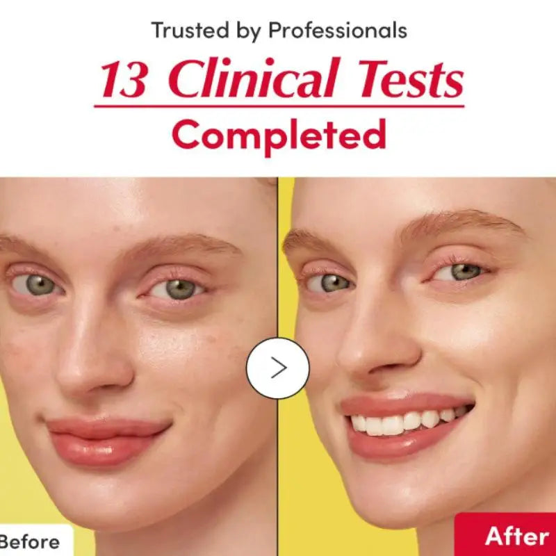 Vitamin C Serum Niacinamide Strengthens Skin Barrier Brightening Retionl Face Serum,Ceramide,Hyaluronic Acid,Korean Skin Care
